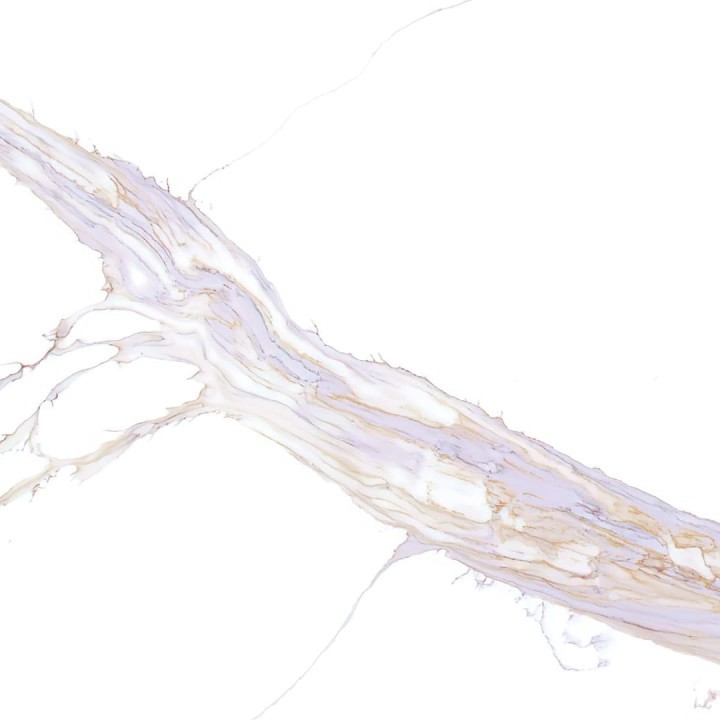 AVANT QUARTZ 7030 Calacatta Chenonceau 1 AVANT QUARTZ 7030 Calacatta Chenonceau